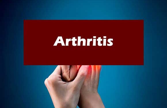 Preventing Arthritis