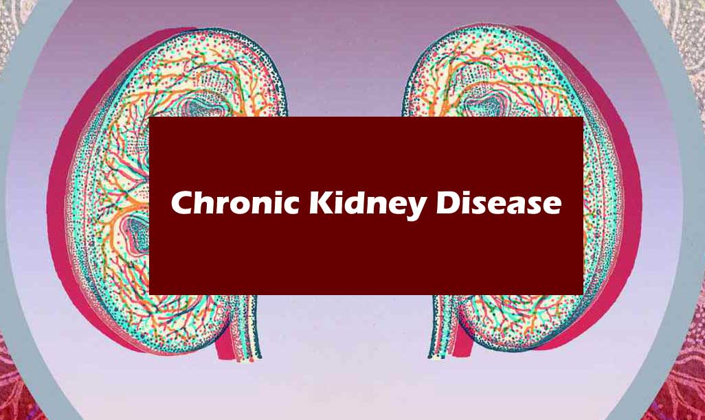 chronic kidney disease