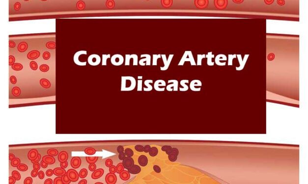 Living with Coronary Artery Disease