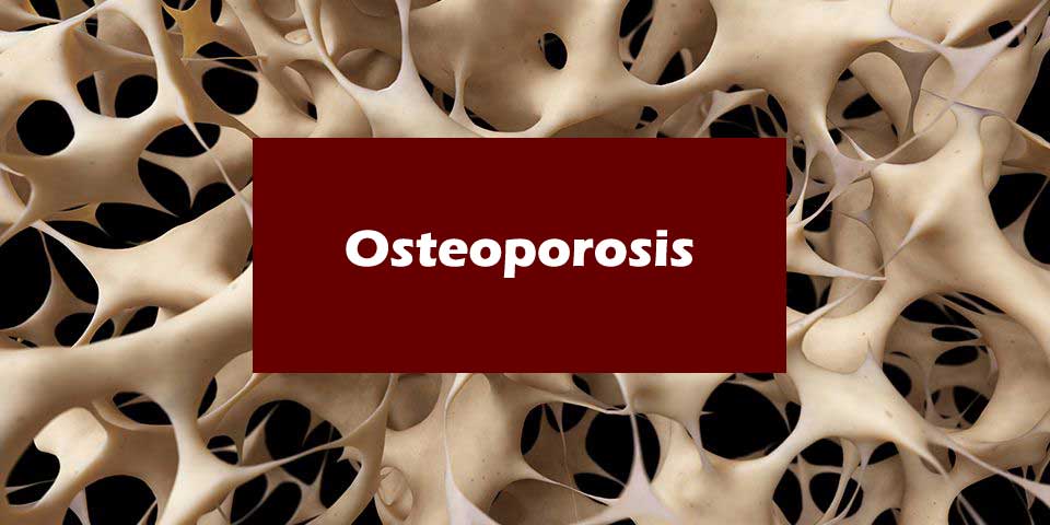 osteoporosis