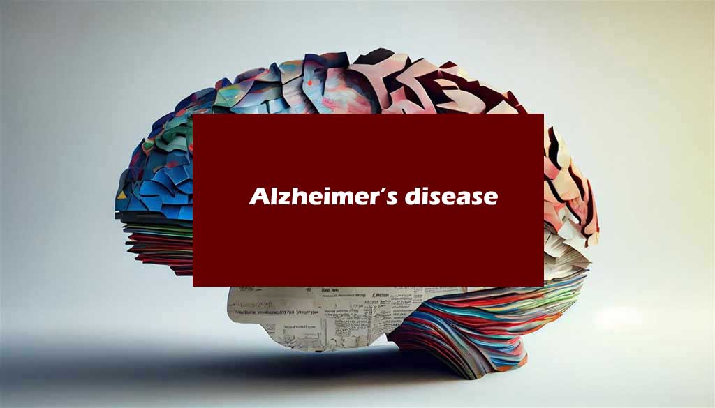 Alzheimer’s disease