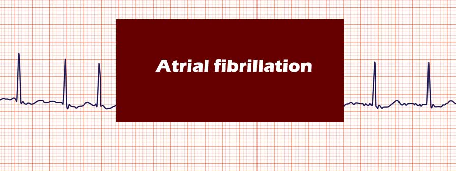 Atrial fibrillation